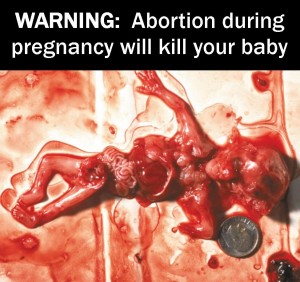 Abortion Warning Label