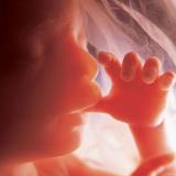 Preborn child Preborn child